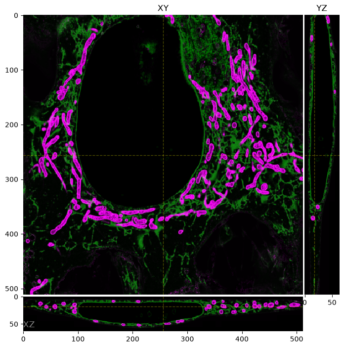 The ER and mitochondria ground truth, one plane