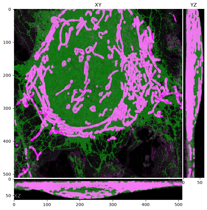 The ER and mitochondria ground truth, maximum projection