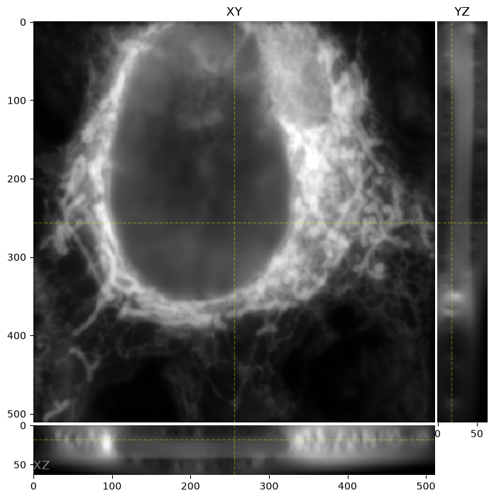 The widefield optical image, with both labels in one channel