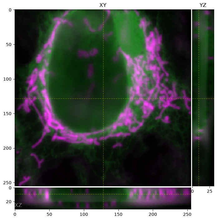 Digital image, 10 ms exposure, 10 W/cm²
