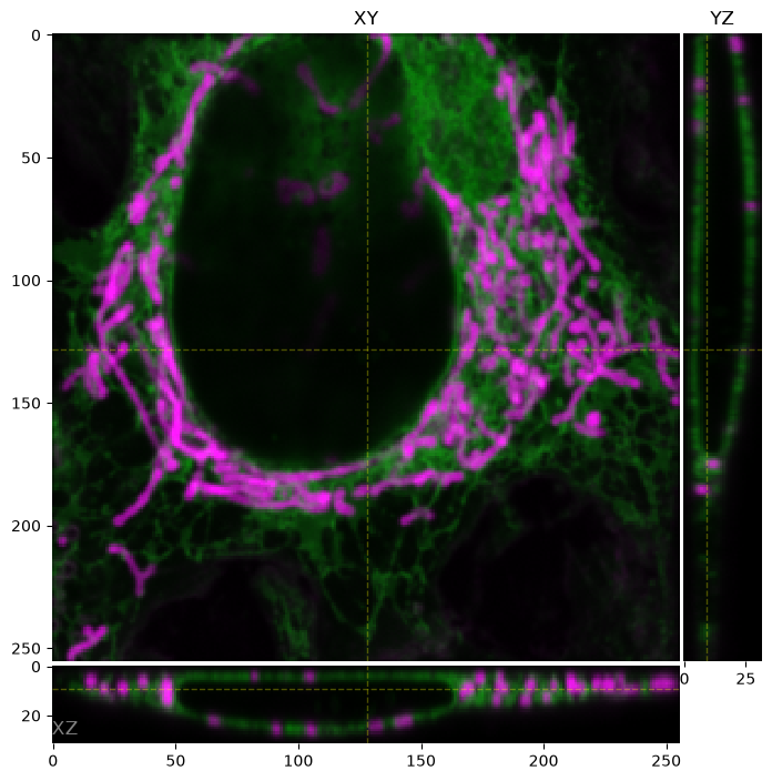 Confocal digital image